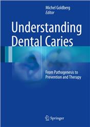 Cover Understanding Dental Caries