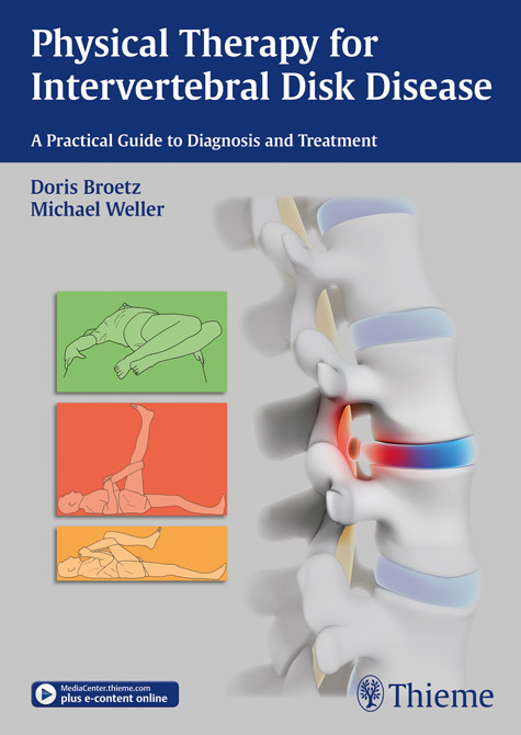 Physical Therapy for Intervertebral Disk Disease