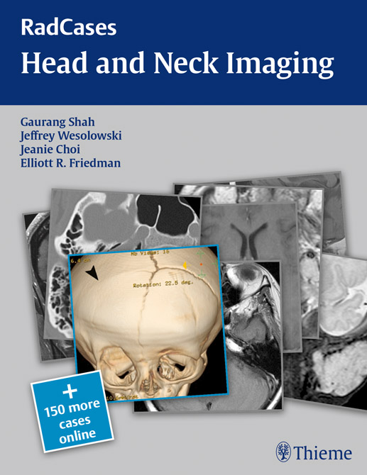 RadCases - Head and Neck Imaging