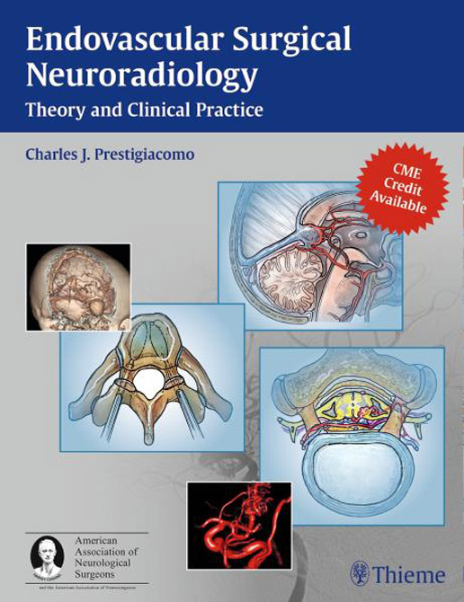 Endovascular Surgical Neuroradiology