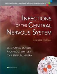 Cover Infections of the Central Nervous System
