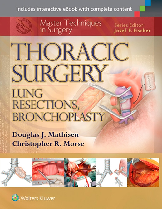 Master Techniques in Surgery: Thoracic Surgery: Lung Resections