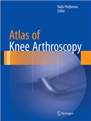 Cover Atlas of Knee Arthroscopy