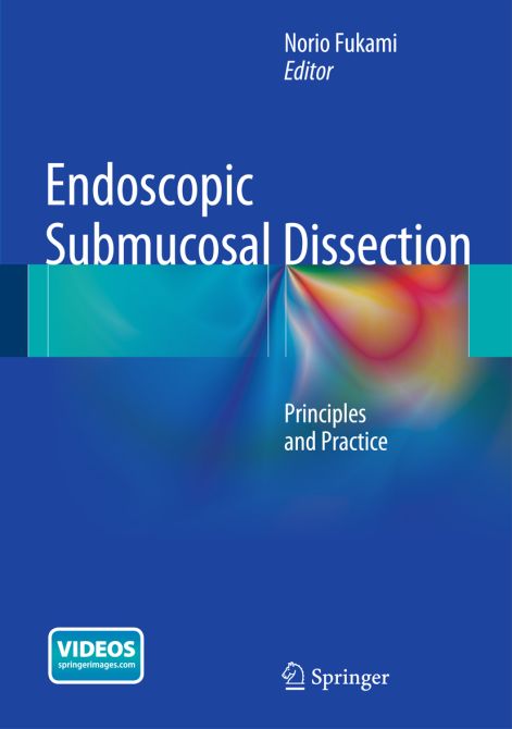 Endoscopic Submucosal Dissection