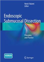 Cover Endoscopic Submucosal Dissection