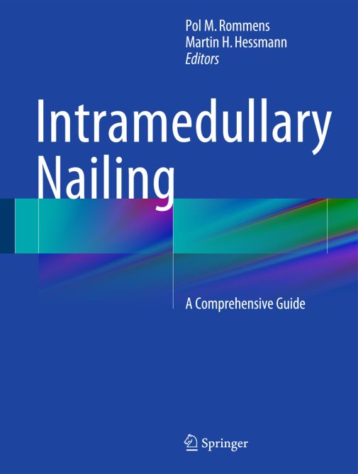 Intramedullary Nailing