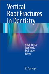 Cover Vertical Root Fractures in Dentistry