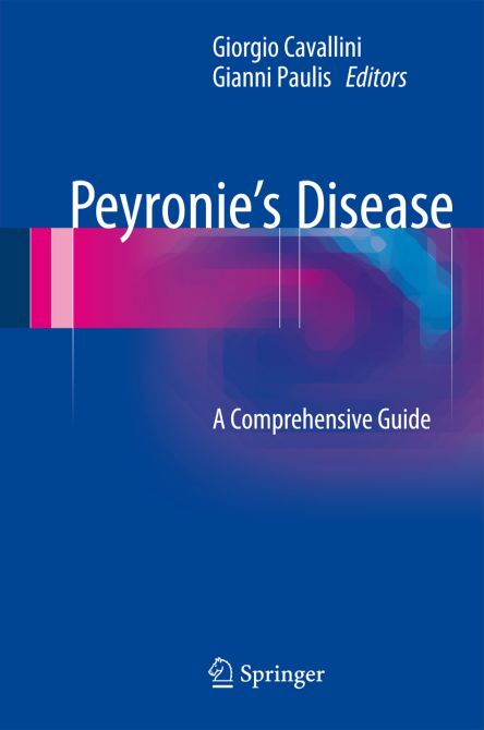 Peyronies Disease