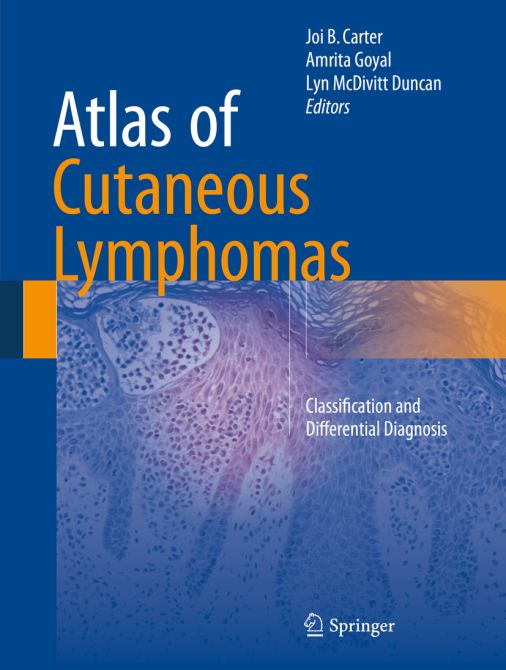 Atlas of Cutaneous Lymphoma