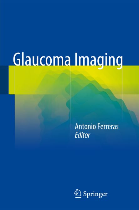 Glaucoma Imaging