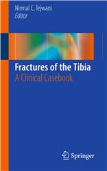 Cover Fractures of the Tibia