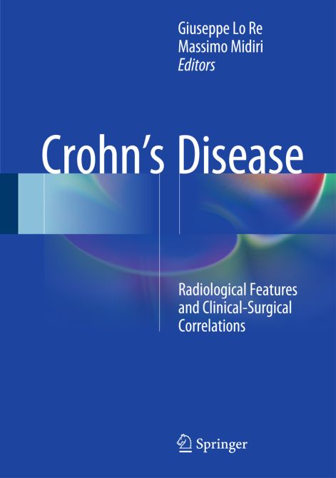 Crohn's Disease