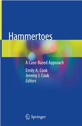 Cover Hammertoes