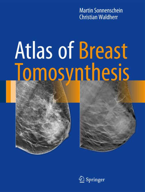 Atlas of Breast Tomosynthesis