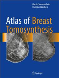 Cover Atlas of Breast Tomosynthesis