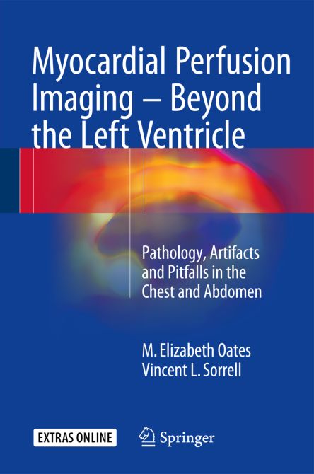 Myocardial Perfusion Imaging - Beyond the Left Ventricle