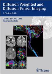 Cover Diffusion Weighted and Diffusion Tensor Imaging