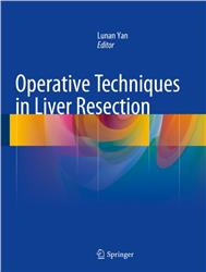 Cover Operative Techniques in Liver Resection