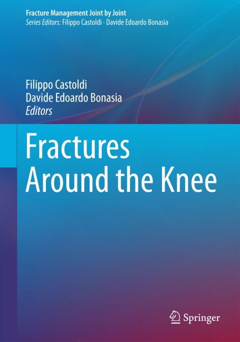 Fractures around the Knee