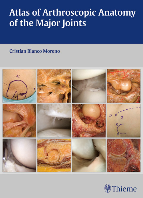 Atlas of Arthroscopic Anatomy of the Major Joints