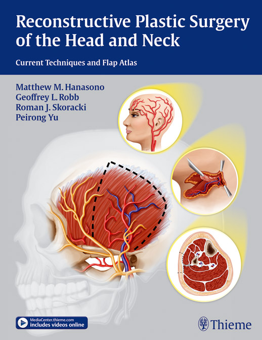 Reconstructive Plastic Surgery of the Head and Neck