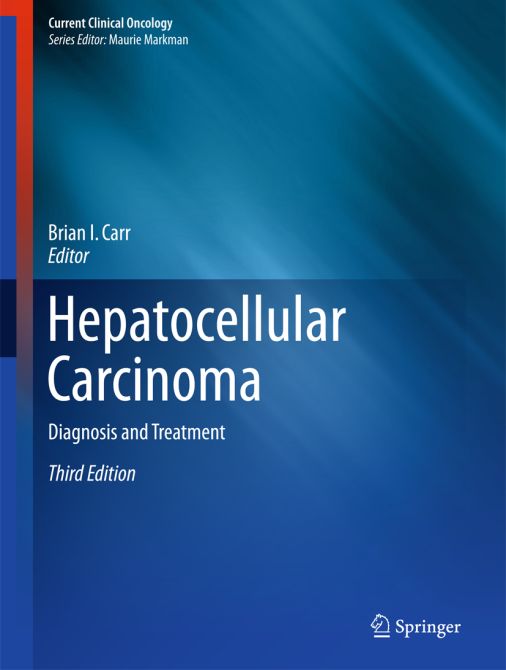 Hepatocellular Carcinoma