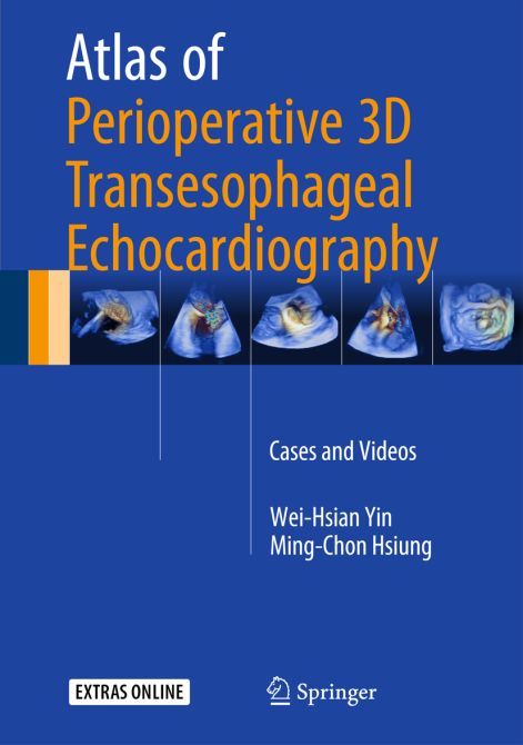 Atlas of Perioperative 3D Transesophageal Echocardiography