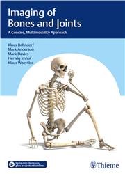 Cover Imaging of Bones and Joints