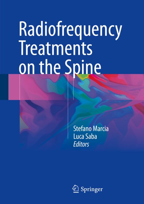 Radiofrequency Treatments on the Spine