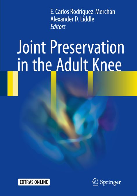 Joint Preservation in the Adult Knee