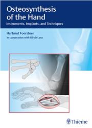 Cover Osteosynthesis of the Hand