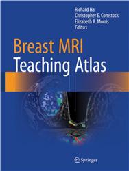 Cover Breast MRI Teaching Atlas