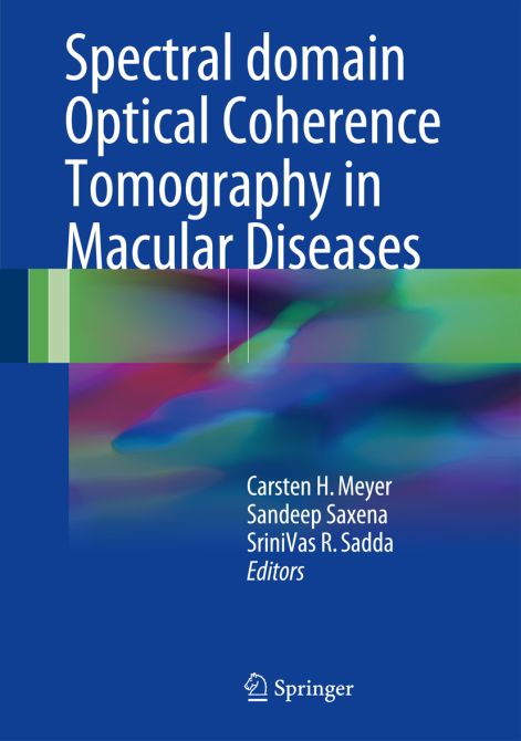 Spectral domain Optical Coherence Tomography in Macular Diseases