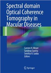 Cover Spectral domain Optical Coherence Tomography in Macular Diseases