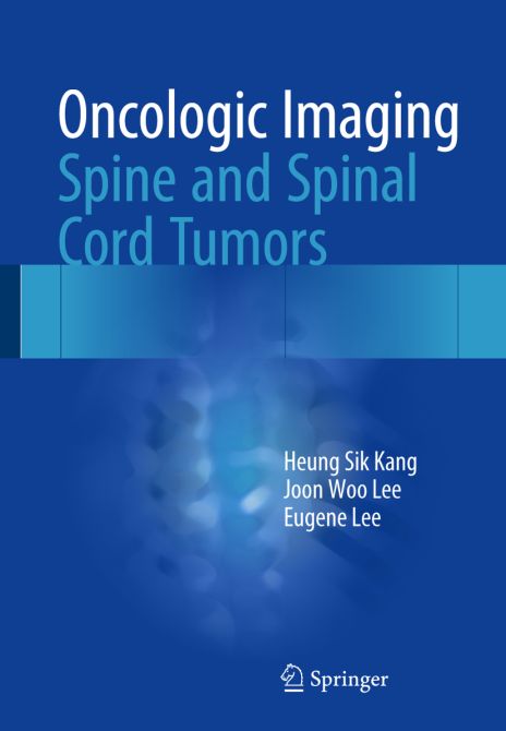 Oncologic Imaging: Spine and Spinal Cord Tumors