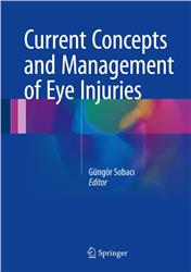 Cover Current Concepts and Management of Eye Injuries