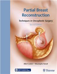 Cover Partial Breast Reconstruction