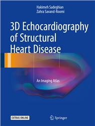 Cover 3D Echocardiography of Structural Heart Disease