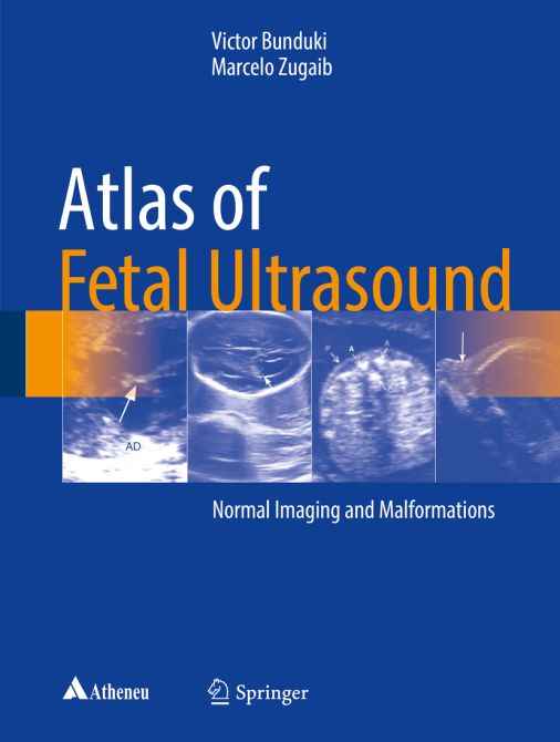 Atlas of Fetal Ultrasound