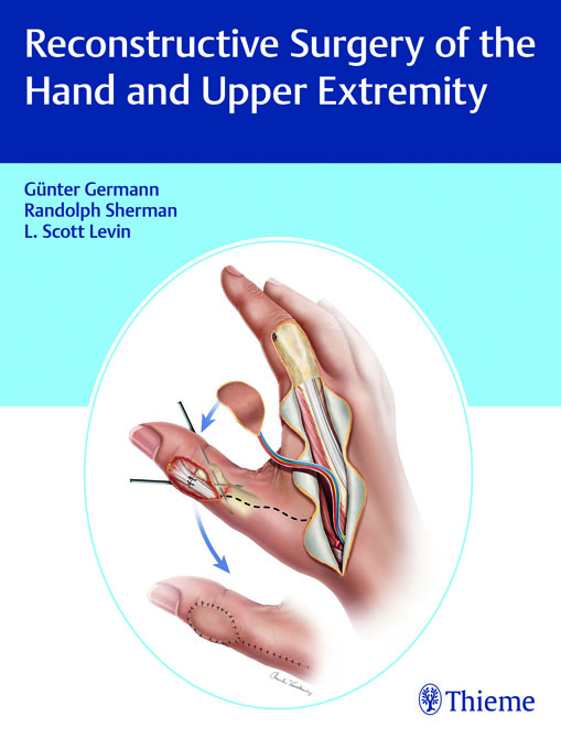 Reconstructive Surgery of the Hand and Upper Extremity