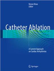 Cover Catheter Ablation