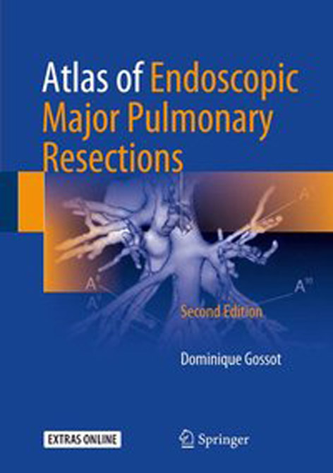 Atlas of Endoscopic Major Pulmonary Resections