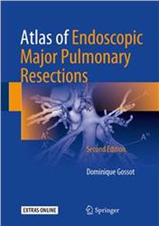 Cover Atlas of Endoscopic Major Pulmonary Resections