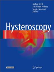 Cover Hysteroscopy