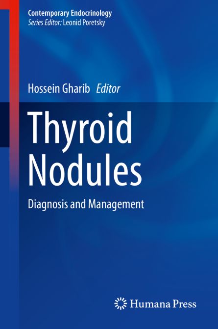 Thyroid Nodules