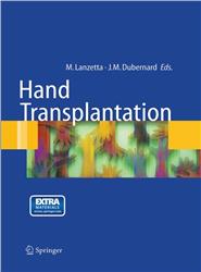 Cover Hand transplantation