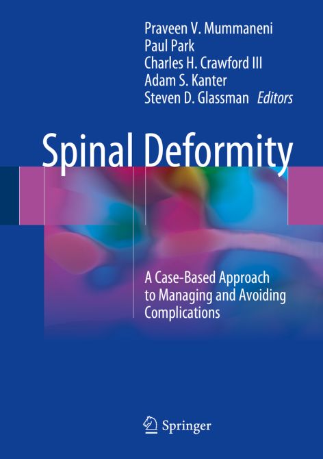 Spinal Deformity