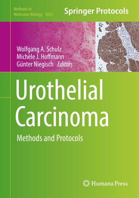 Urothelial Carcinoma