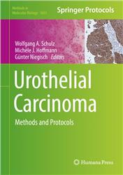 Cover Urothelial Carcinoma