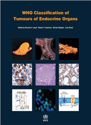 Cover WHO Classification of Tumours of Endocrine Organs